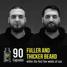 Beard Grow XL, Vegan Beard Grower Facial Hair Supplement, #1 Men’s Hair Growth Vitamins